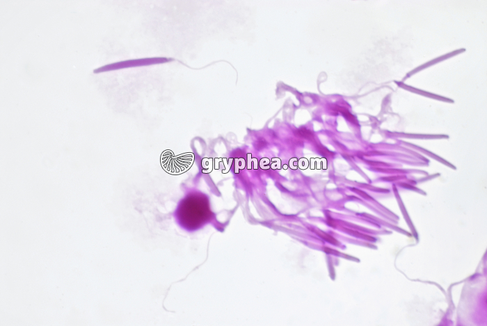 Grenouille - Spermatozoïdes x200 - gryphea.com